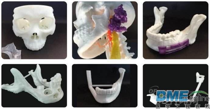 3D打印技术在医疗领域潜力巨大