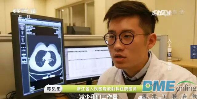 医疗影像界Alphago首秀央视