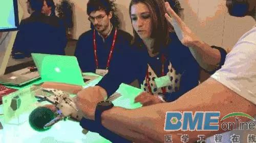 媲美终结者的灵活机械义肢问世
