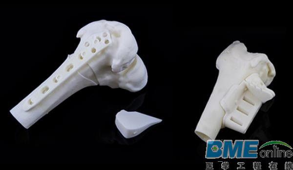FDA许可Materialise公司制造儿科3D打印手术导板