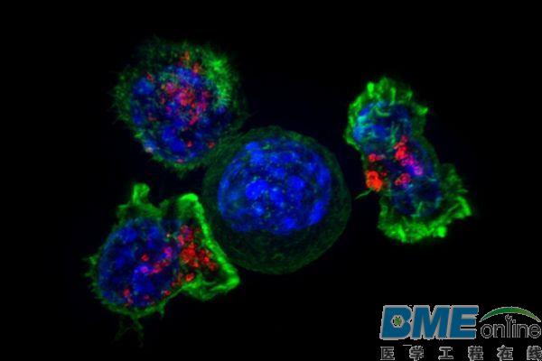 科学家发现可有效抵御乳腺癌干细胞的关键蛋白Numb