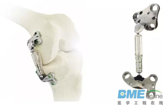 Moximed公司研发治疗膝关节炎的植入器：并完成5千万美元C轮融资