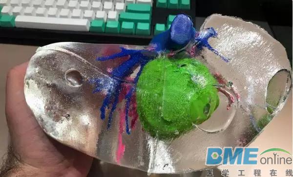 2017年3D打印技术在医疗领域的七大研究进展