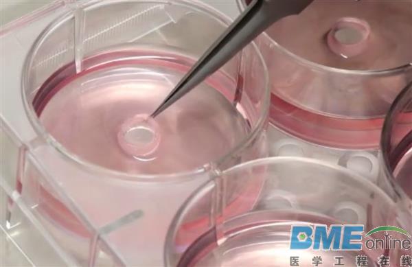 研究人员为血管缺陷儿童开发3D打印血管材料
