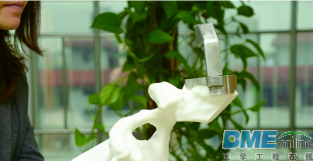 3D打印已成为骨科医生的好帮手