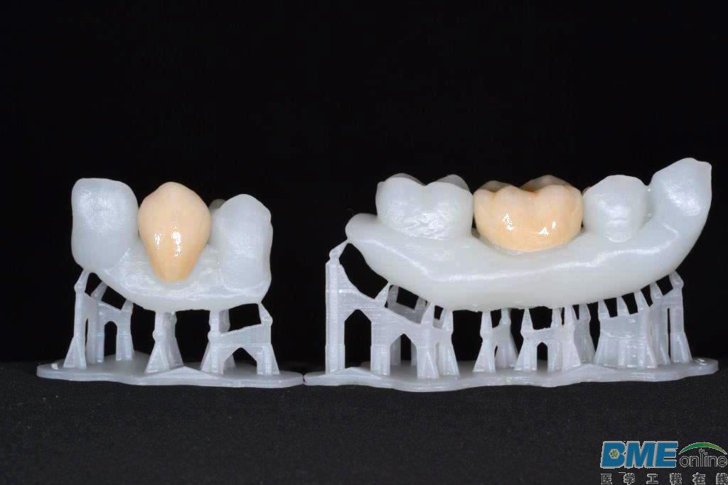 北京大学口腔医学院唐志辉教授将开展3D打印临床试验