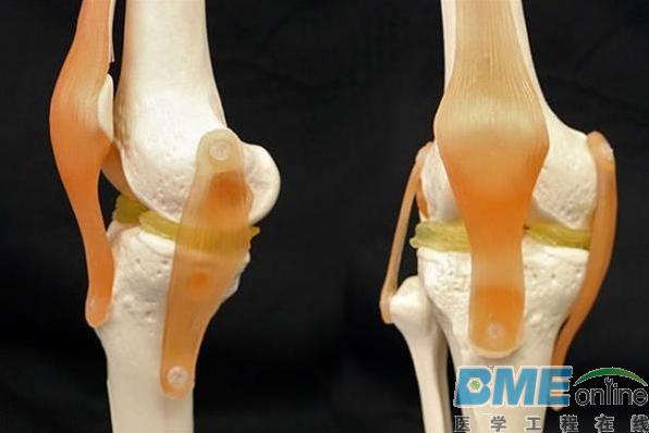 杜克大学发现可修复膝盖损伤的3D打印软骨材料