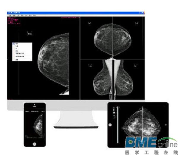 人工智能乳腺癌诊断系统获得CFDA认证