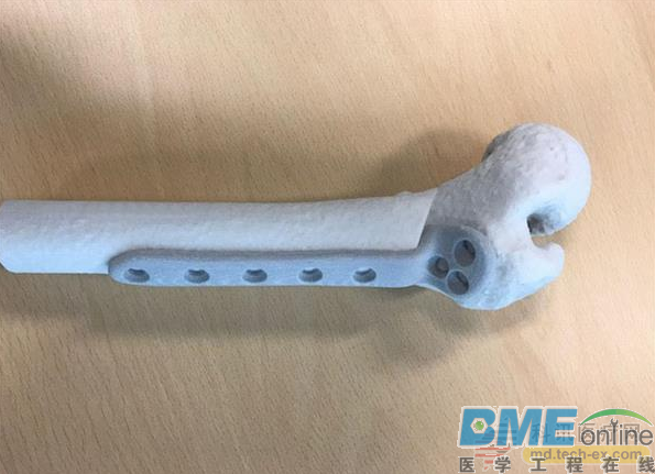 阿姆斯特丹OLVG医院成功植入荷兰首款3D打印髋骨