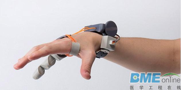 英国学生研发出3D打印手指：或打破传统义肢观念