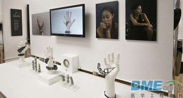 英国学生研发出3D打印手指：或打破传统义肢观念