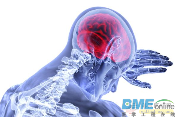 科学家 3D 生物打印大脑模型用于研究神经退行性疾病