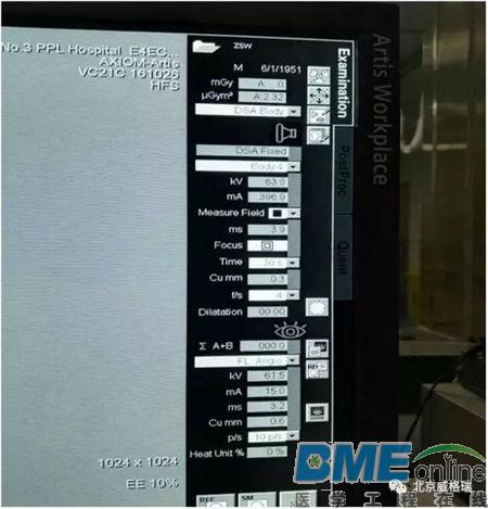 西门子DSA AXIOM Artis Zee Ceiling更改程序默认焦点