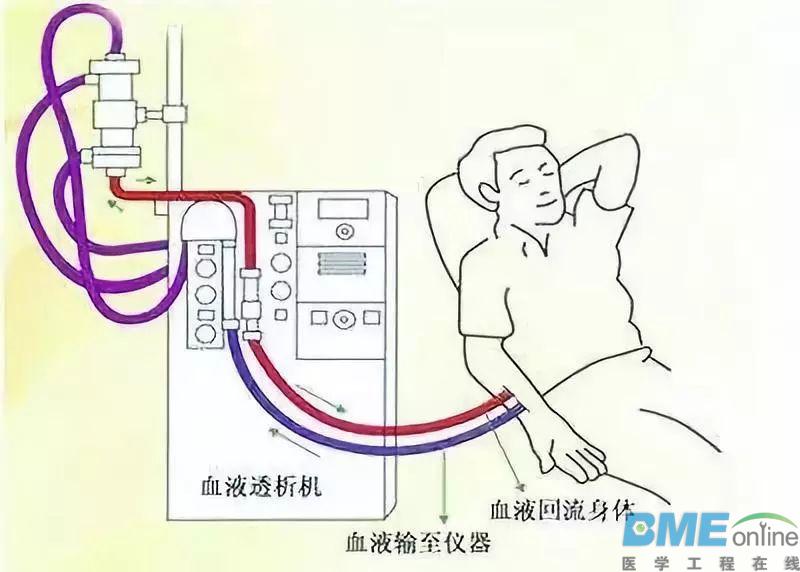 费森尤斯血液透析机不同故障相同报警的维修