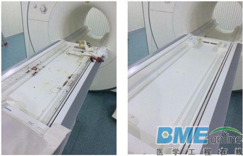 西门子 1.5T MR(MAGNETOM Aera)左侧线圈插座盖板无法打开故障维修