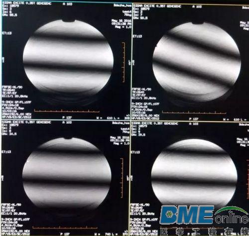 GE SIGNA OVATION 0.35T MR梯度伪影维修