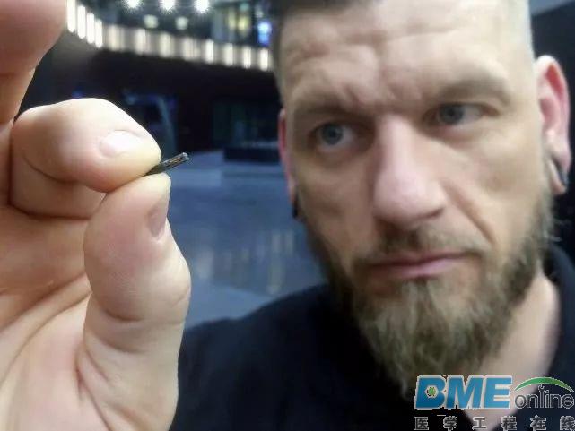 在瑞典，已经有超过4000人在身体中植入了芯片