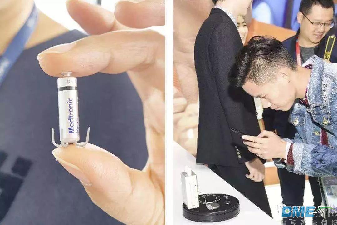 美敦力将刷新全球最小心脏起搏器记录！