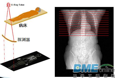 为什么多层螺旋CT能风靡世界20年？