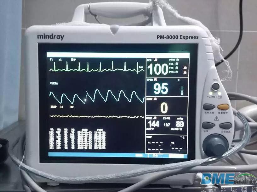 带你了解更全面的监护仪的种类和历史